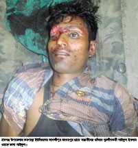 রামগঞ্জে যুবলীগকর্মীকে গুলি করে হত্যা
গ্রেফতার ১